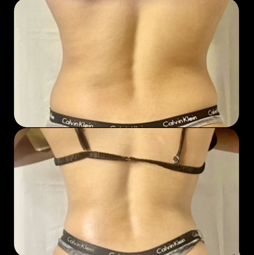 Back โ Client Photo Comparison 9