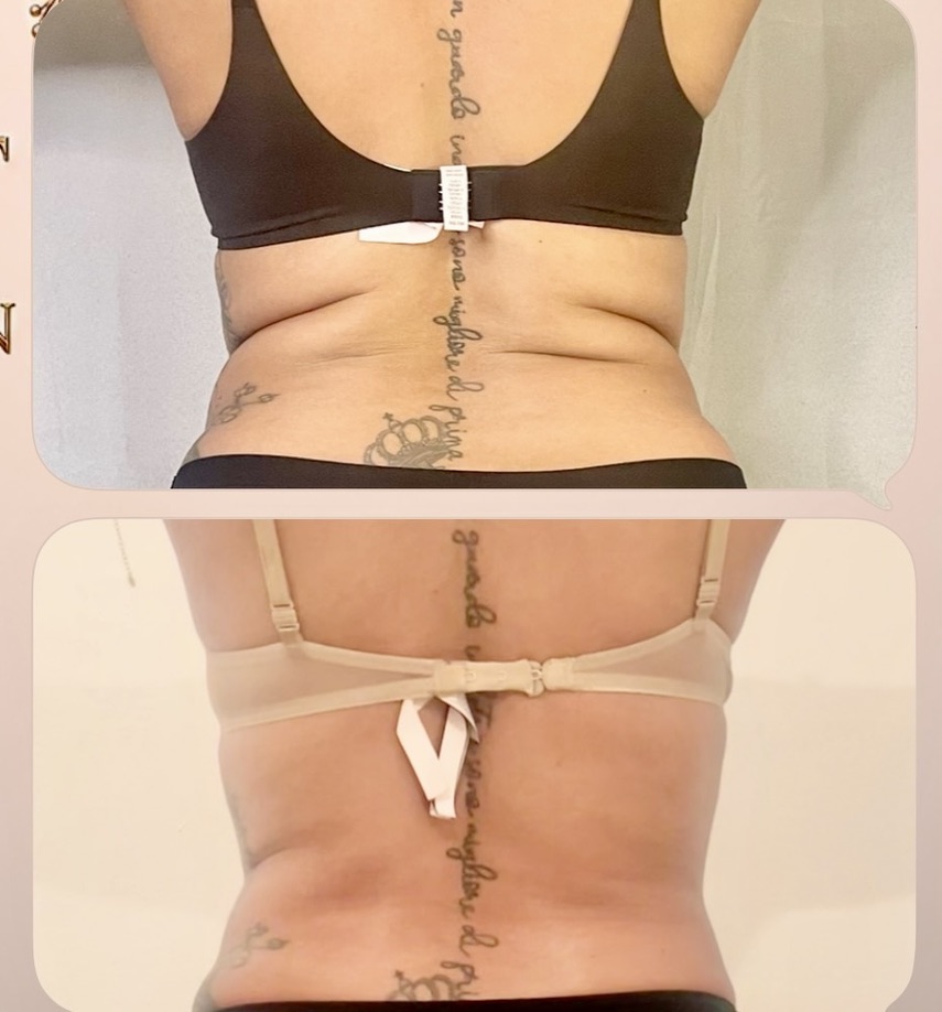 Back โ Client Photo Comparison 2