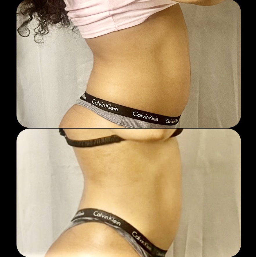 Side Profile โ Client Photo Comparison 15