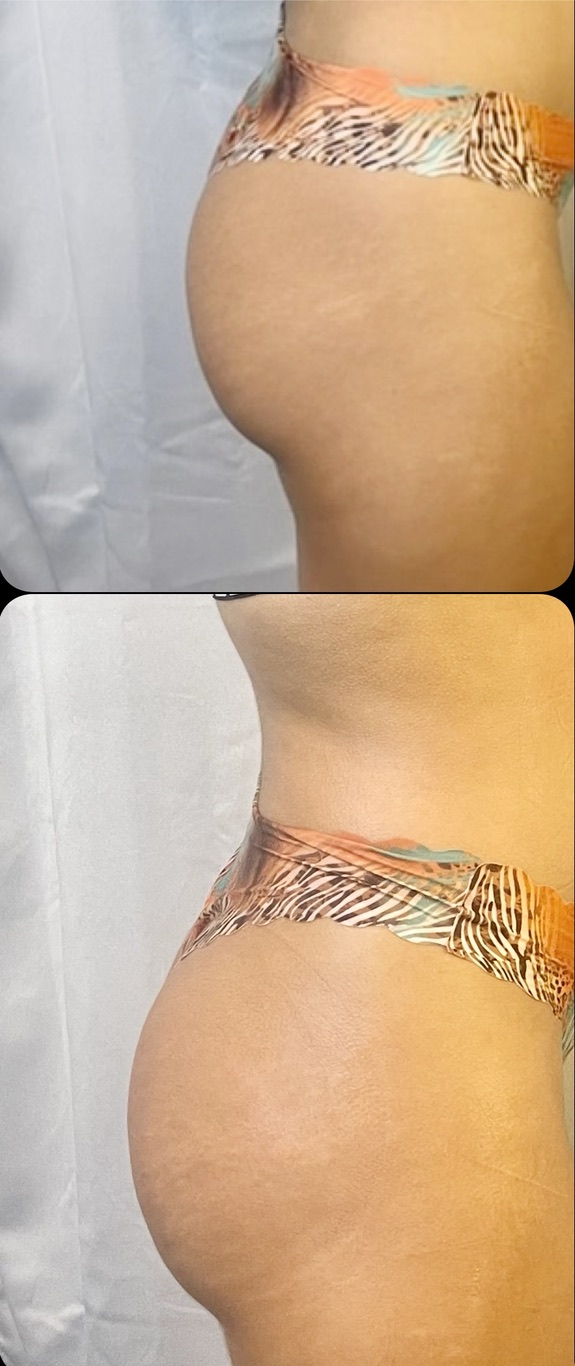 Curve Profile โ Client Photo Comparison 16