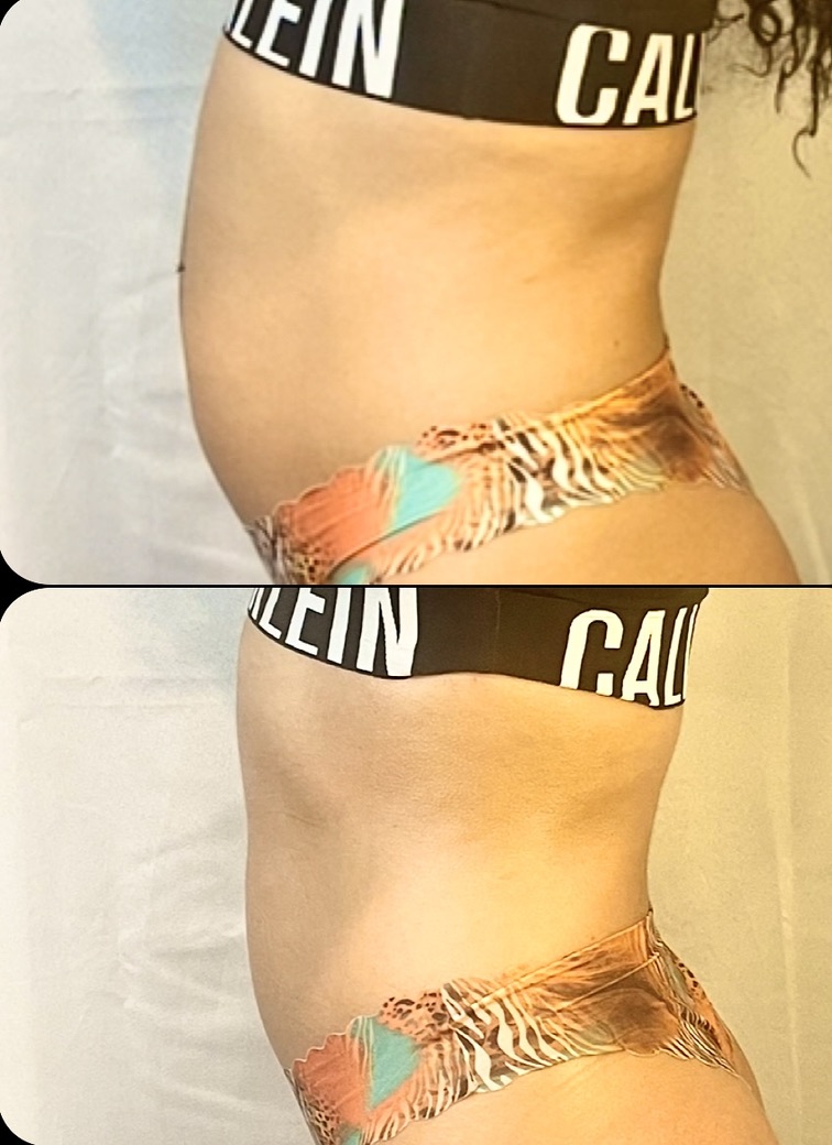 Side Profile โ Client Photo Comparison 6