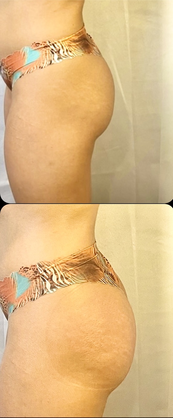 Curve Profile โ Client Photo Comparison 13