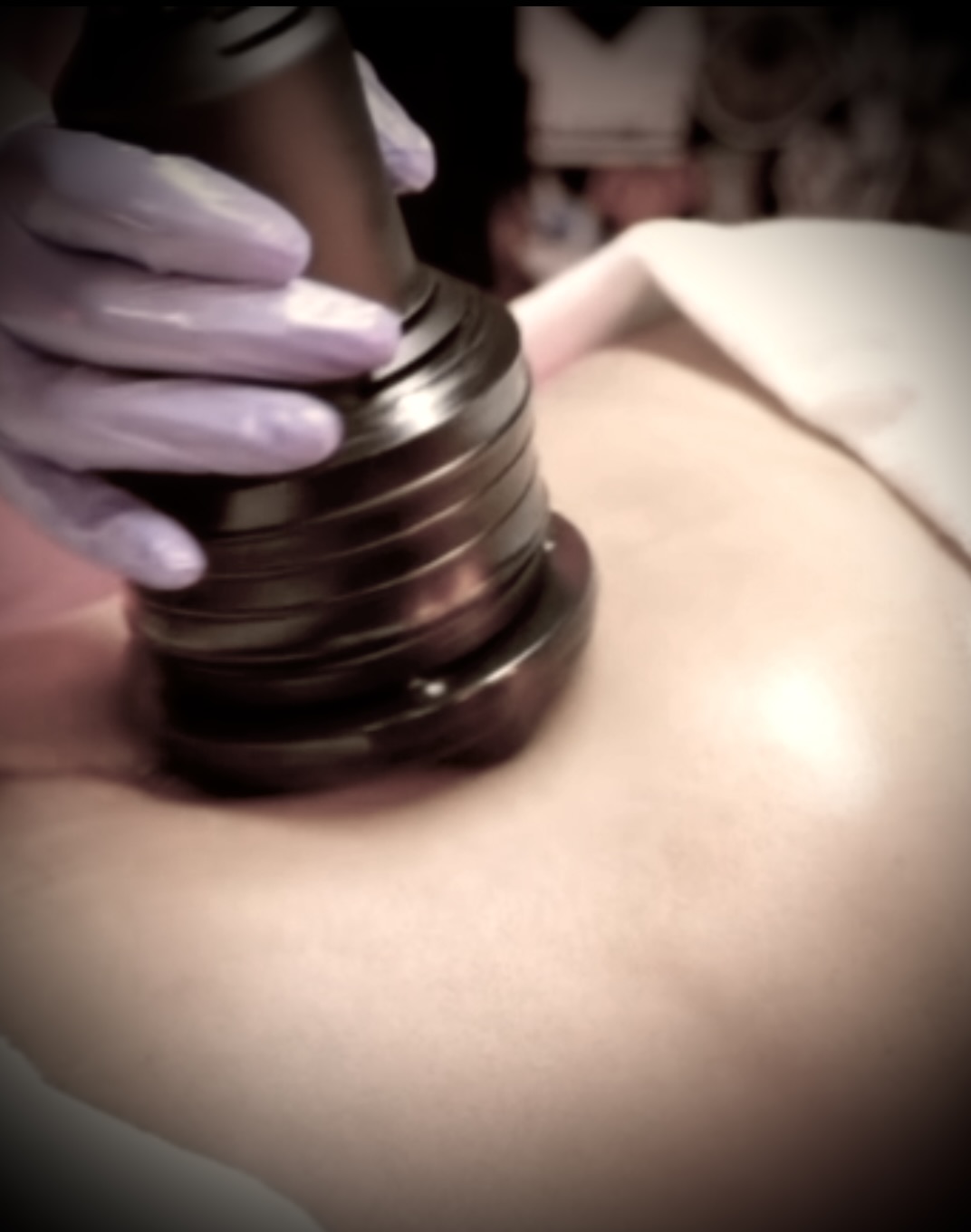 ⚜️ G5✧SmoothContour™✨Cellulite Contour Therapy