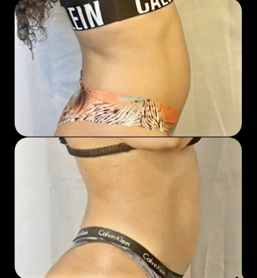 Side Profile โ Client Photo Comparison 12