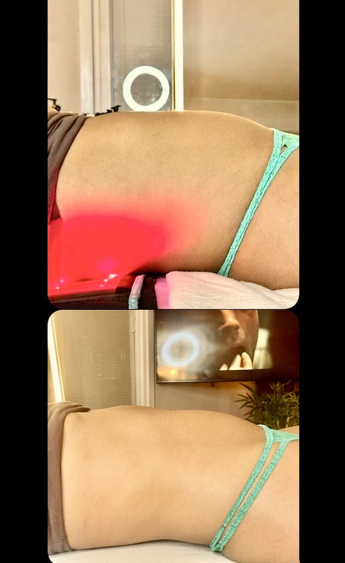 Curve Profile โ Client Photo Comparison 14