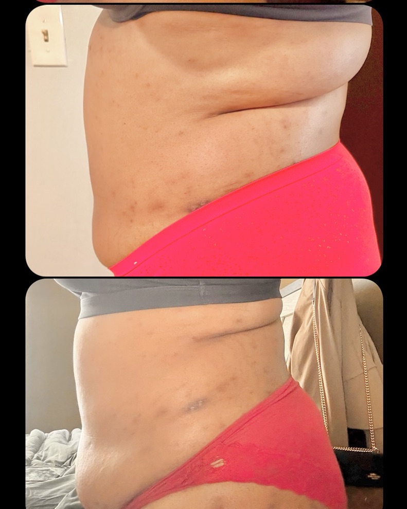 Side Profile โ Client Photo Comparison 5