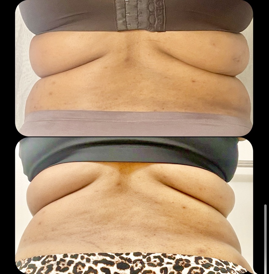 Back โ Client Photo Comparison 4